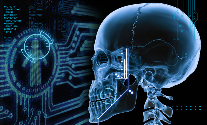 3Dskull1